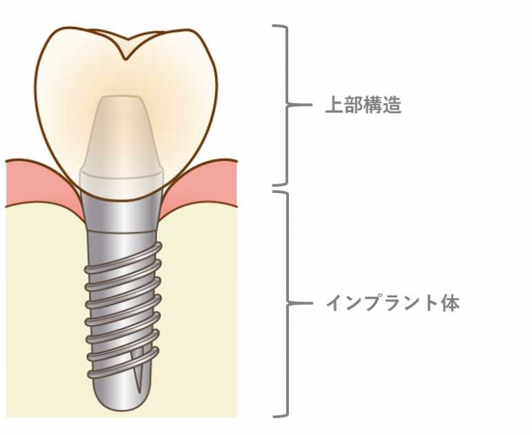 上部構造