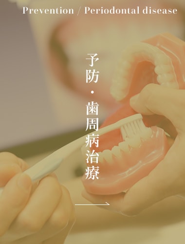 予防・歯周病治療