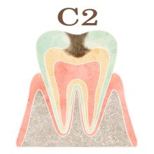 C2