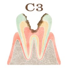 C3